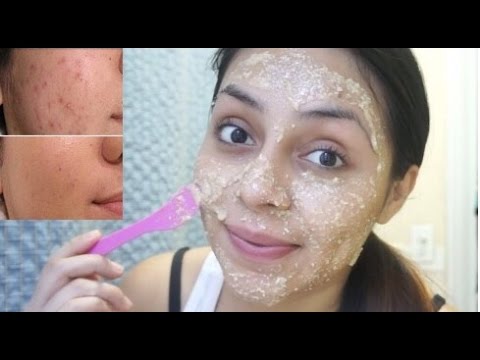 Elimina el Acne en dias | Mascarilla de Avena