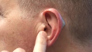 Your Healthy Family: The challenges of hearing loss and hearing aids