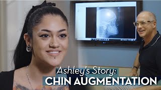 Chin Augmentation Helps Change Ashley’s Life | Atlanta Dental Implant Specialists | Alpharetta, GA