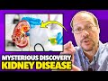 Mysterious Kidney Disease Discovery In Agriculture Workers
