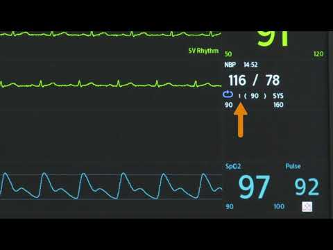 Monitoring using the