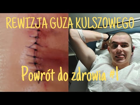 *REWIZJA GUZA KULSZOWEGO* Powrót do zdrowia po operacji #1