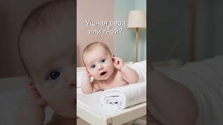 В ухе сера или гной? #детскийлор #брест #ухо