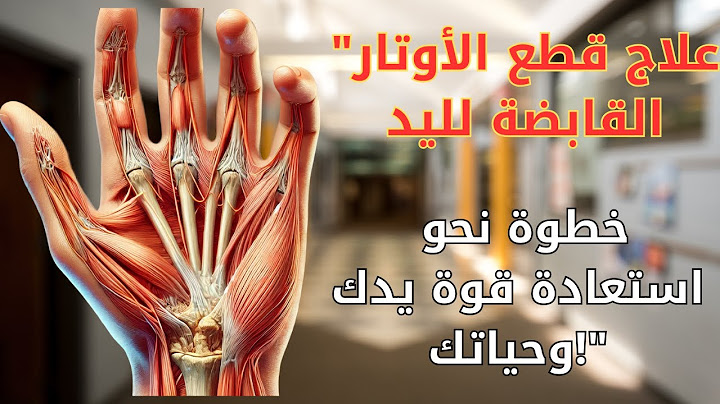 قطع أوتار اليد.كيفية علاج قطع الأوتار باليد.قطع الاوتار القابضة لليد.علاج قطع اوتار اليد.جراحة اليد