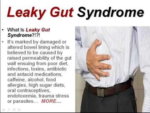 #1 What Is Leaky Gut Syndrome? ~ Check Out Our Leaky Gut Syndrome Cure