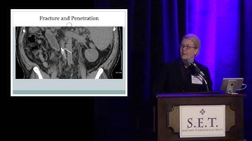 Troublesome Trends in IVC Filter Use & Late Failure