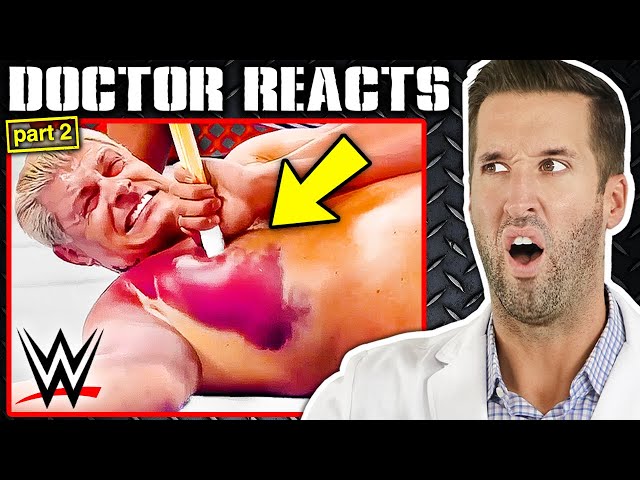 ER Doctor REACTS to Jaw-Dropping WWE Injuries #2 class=
