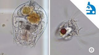 Algae Corner: &quot;What Is It?&quot; - Rotifers