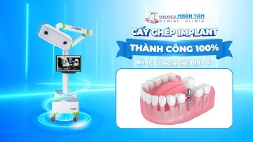CẤY GHÉP IMPLANT THÀNH CÔNG 100% BẰNG CÔNG NGHỆ ĐỊNH VỊ