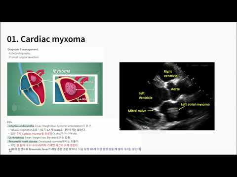 KMLE 강의 시리즈 - Cardiology, 17) 심장종양, 감염성 심내막염