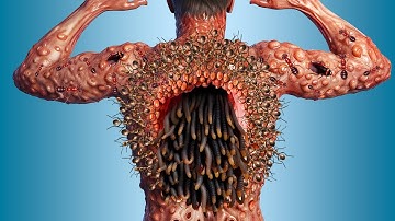 Deep Cleaning Animation - ASMR Removing Ticks, Maggots and insects from Back