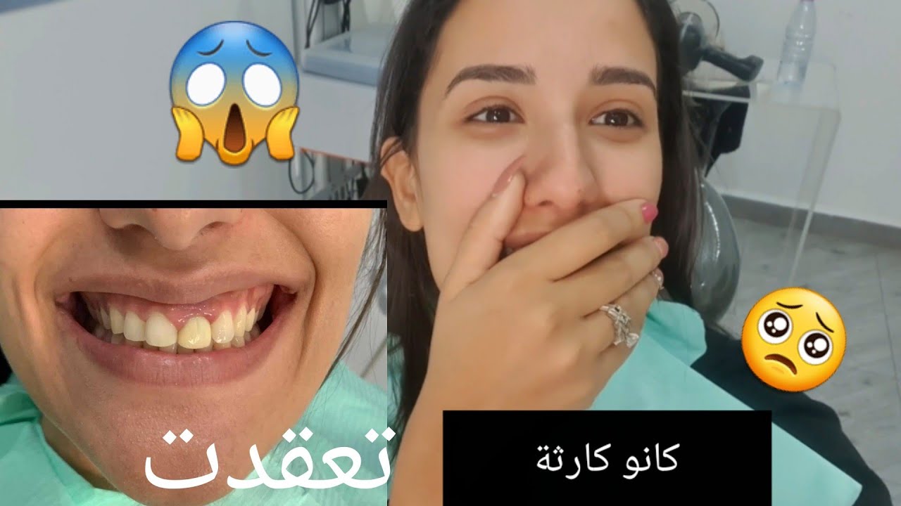 و اخيرافيديو  اسناني 😁 راح تنصدموا  اول مرة نوري روحي هاكا ما تضحكوش عليا 😑😒 الجزء الأول