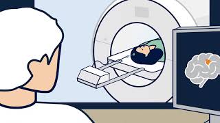 Laser Ablation (LITT) for Brain Tumors
