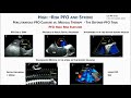 Cryptogenic stroke with pfo  ready to close  yes