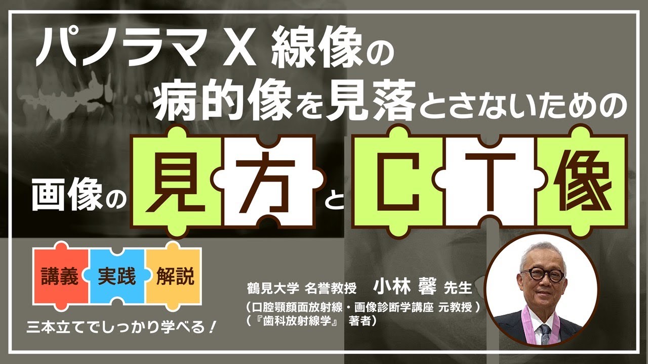 講演紹介】パノラマX線像の病的像を見落とさないための画像の見方とCT