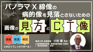 講演紹介】パノラマX線像の病的像を見落とさないための画像の見方とCT