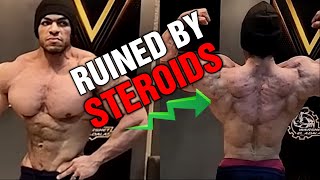 Steroids Ruined Him.