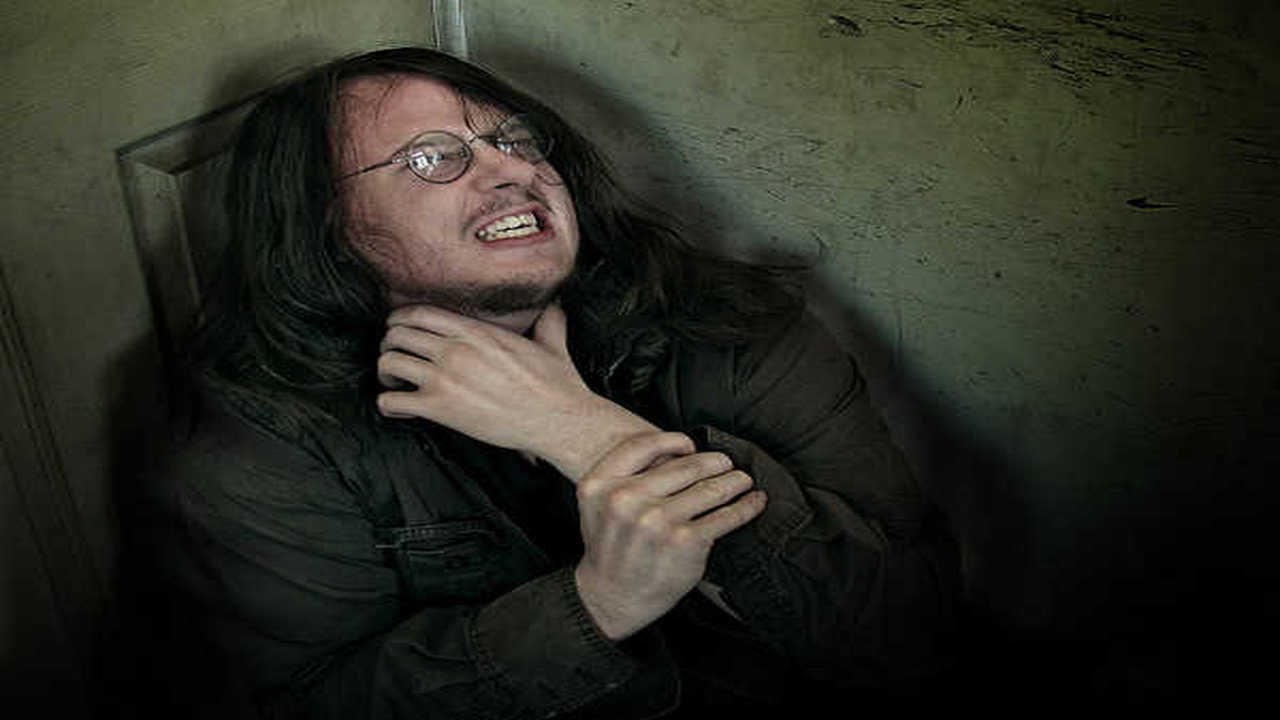 10 Síndromes Extraños en Seres Humanos - YouTube