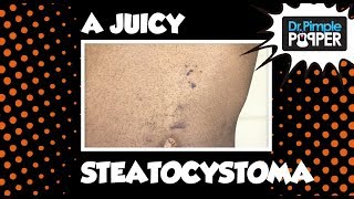It's About to get JUICY in here! It's About to get JUICY in here!