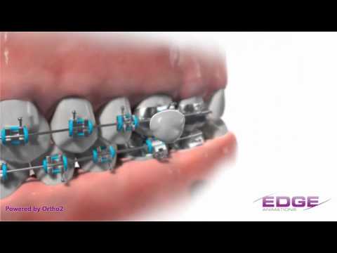 Edge Animations Wax