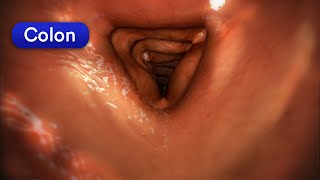 How does your body turn food into poop? Human digestive system screenshot 4