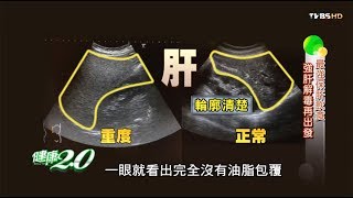 咖啡改善脂肪肝連醫生都說好的保肝秘方大公開健康2.0(完整版)