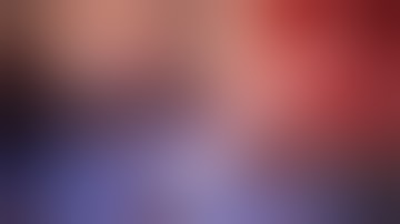 Double-Barrel STA-MCA Bypass, Partial Trapping of Ruptured Mycotic MCA Aneurysm w/Flash Fluorescence