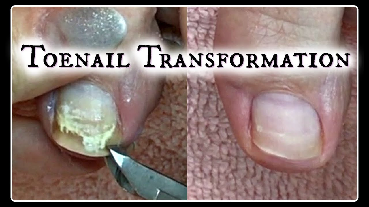 Pedicure Tutorial Toenail Transformation And Time Saving Tips Pedicure Tutorial Toenail Transformation And Time Saving Tips