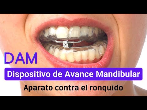 Dispositivos de avance mandibular en el tratamiento del síndrome