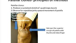 Position for ankle and patellar clonus