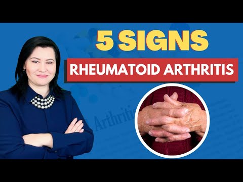 Rheumatoid Arthritis- What are the most common signs and symptoms?