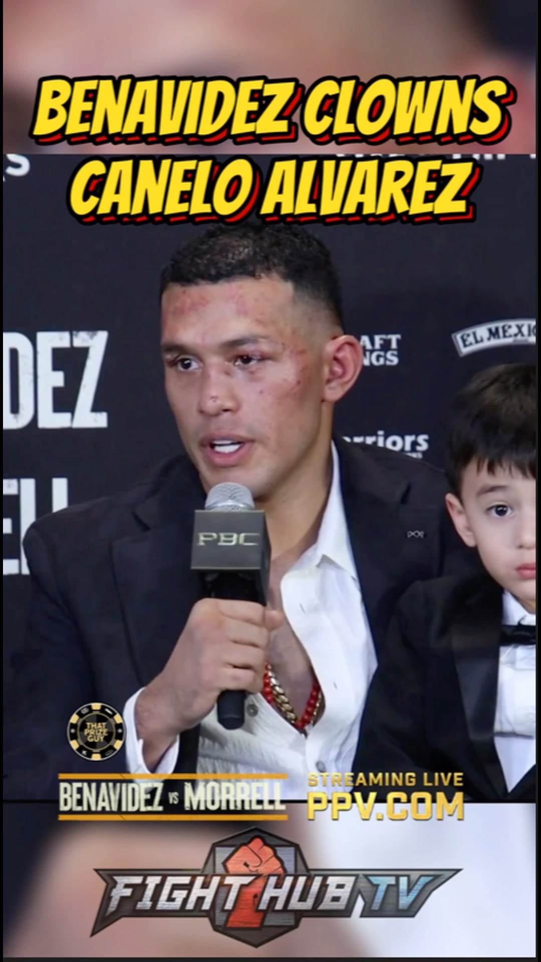 Benavidez CLOWNS Canelo over disrespect; would still like the fight!