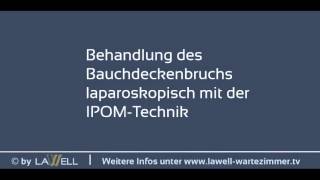 Behandlung Des Bauchdeckenbruchs