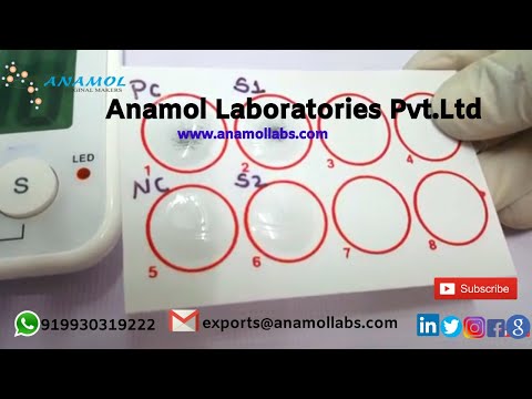 RPR Antigen Test | RPR Test Procedure.