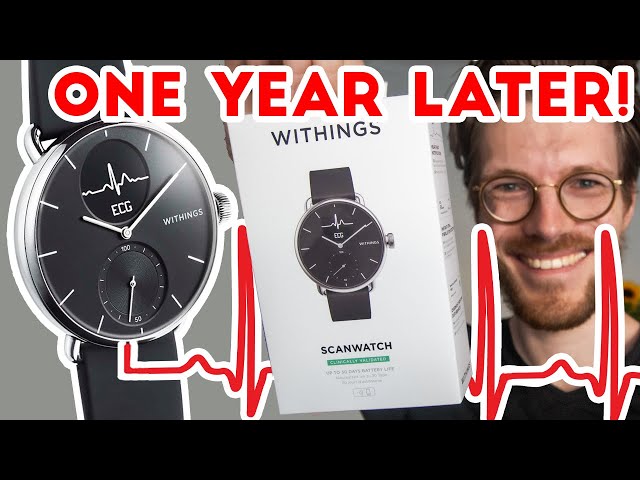 Withings Scanwatch: Scientific Heart Rate Test (One Year Later)