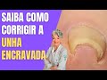 Saiba Como Corrigir Unha Encravada