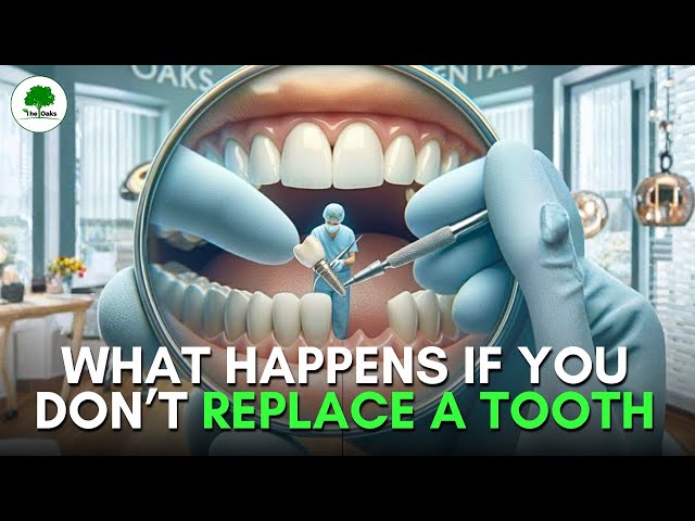 Missing a Tooth? Don't Ignore it | Dental Implants at Oaks Dental Clinic 🦷