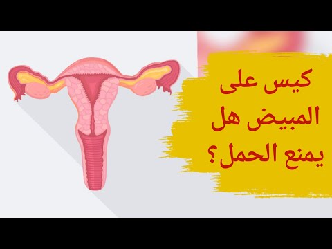 فيديو: هل يمكن لكتلة adnexal أن تمنع الحمل؟