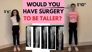 GETTING SURGERY TO BE TALLER | adding 4 inches to my height