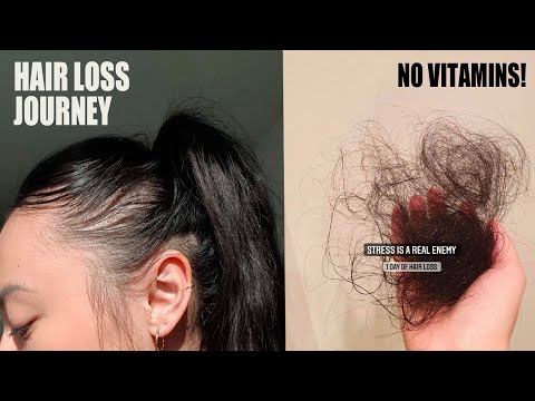 STRESS Was THINNING My Hair ? Hair Update | My Hair Loss Journey