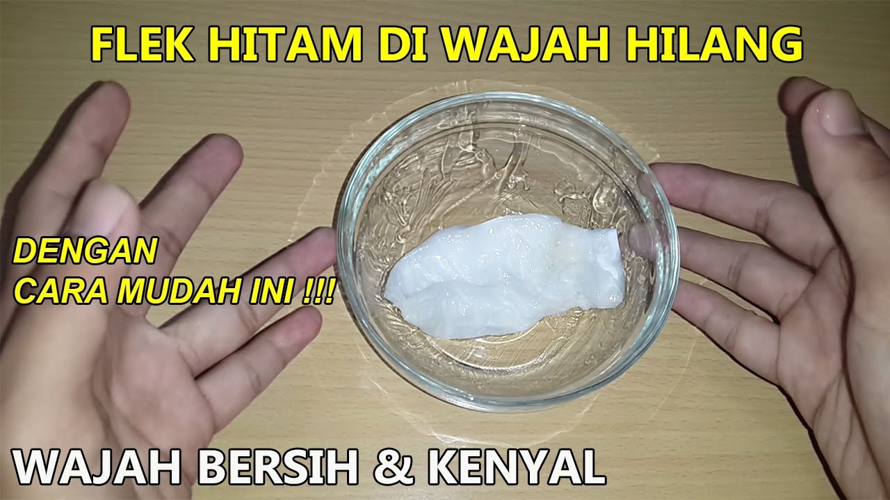 Cara Menghilangkan Flek Hitam Dalam 20 Menit 