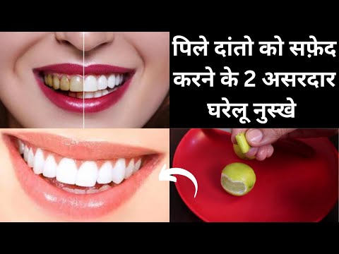 वीडियो: कम लागत में दांत सफेद कैसे करें: 10 कदम (चित्रों के साथ)