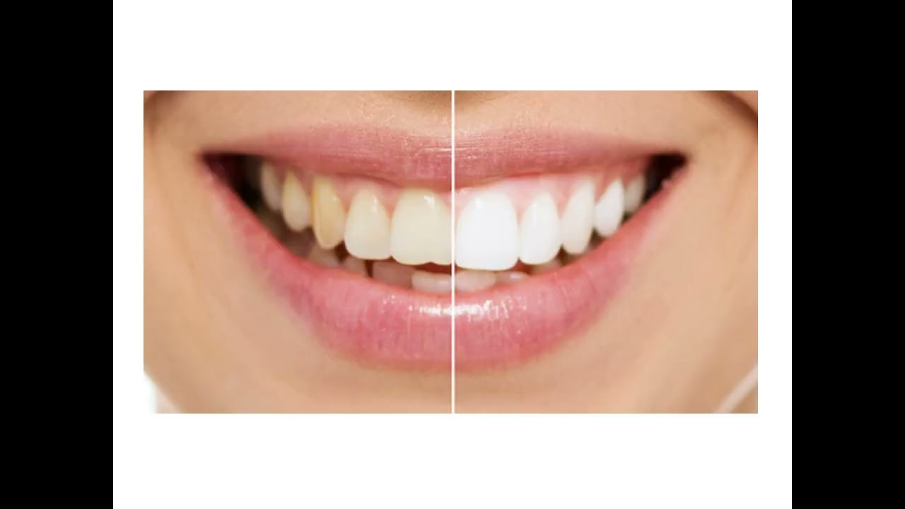 Advanced Dentistry of Coral Springs - Experienced Dentist in Coral Springs, FL