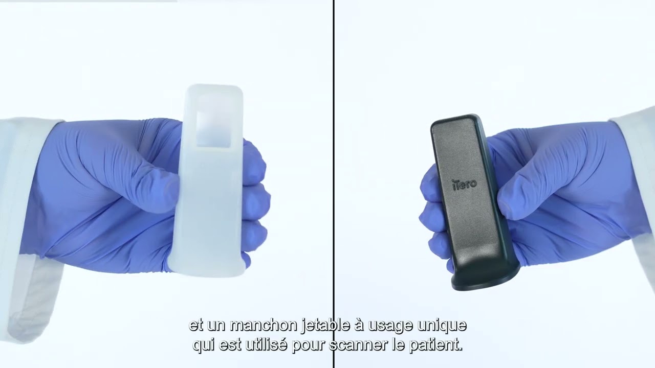 Pièce à main iTero™ Lumina