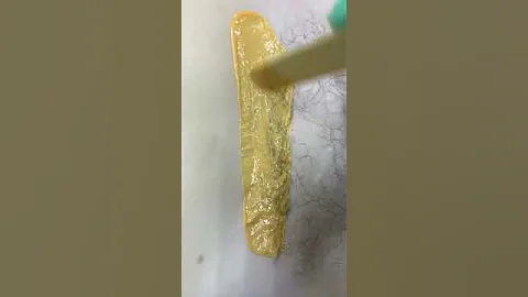 Депиляция бикини