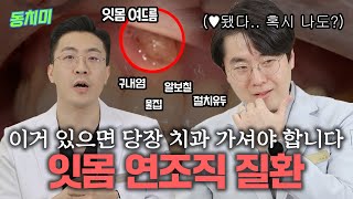 입에 물집이 잡혔어요! 여드름이 생겼어요ㅠㅠ 입에 빵꾸 났어요 | 잇몸에 생기는 질환 총정리 (물집, 여드름, 구내염, 절치유두)
