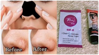 How to remove  blackheads from nose || grow up with asma