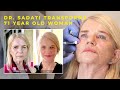 Dr sadati transforms 71 year old woman with lower face and neck lift and restylane lyft filler