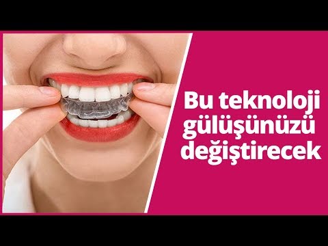 Bu teknoloji gülüşünüzü değiştirecek!