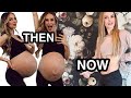 My Postpartum Belly After Triplets | Reducing Stretch Marks | It's Been Working!
